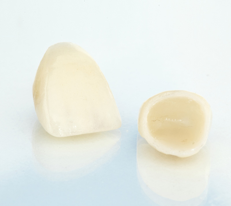 Dental-Crowns-1 Dr. Peter Servinis
