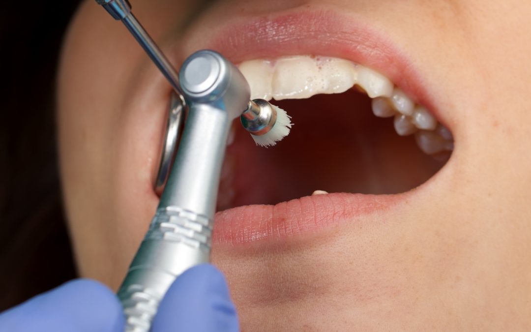 dentist performing dental checkup
