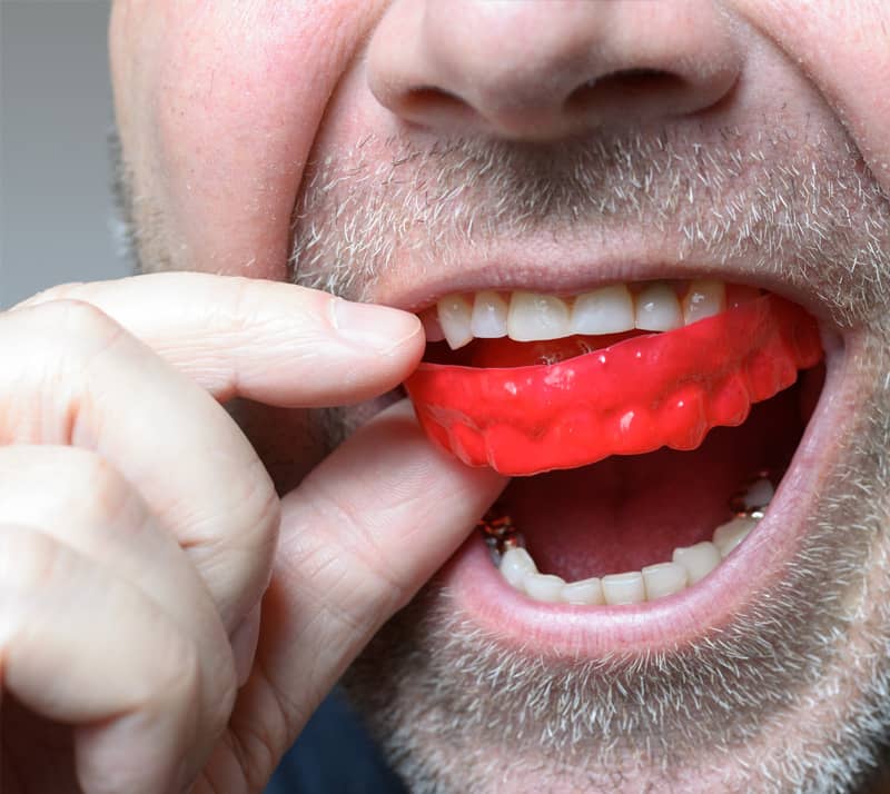 man wearing retainer